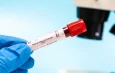 Épidémie d&rsquo;Ebola en RDC: l&rsquo;OMS déclare une urgence internationale, son deuxième niveau d&rsquo;alerte le plus élevé