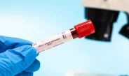 Épidémie d&rsquo;Ebola en RDC: l&rsquo;OMS déclare une urgence internationale, son deuxième niveau d&rsquo;alerte le plus élevé