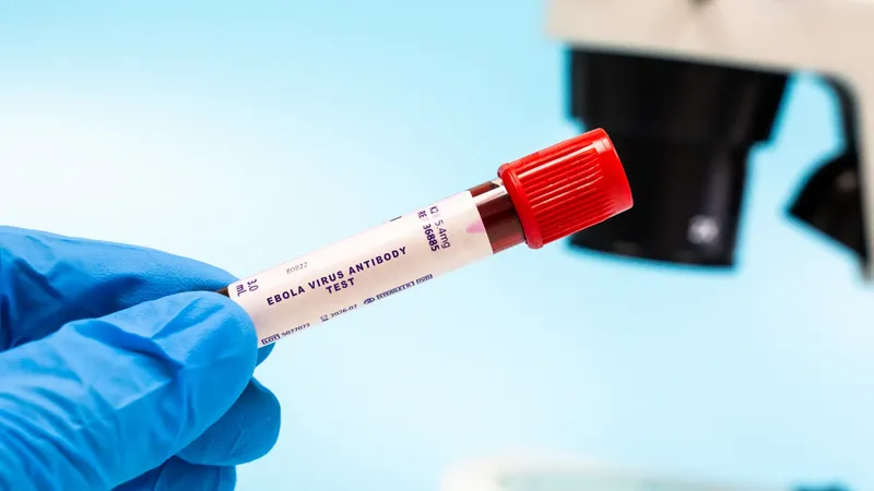 Épidémie d&rsquo;Ebola en RDC: l&rsquo;OMS déclare une urgence internationale, son deuxième niveau d&rsquo;alerte le plus élevé